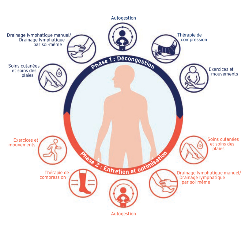 Diagramme montrant les deux phases de la thérapie décongestive complexe/combinée et leurs éléments. Diagramme montrant les deux phases de la thérapie décongestive complexe/combinée et leurs éléments.